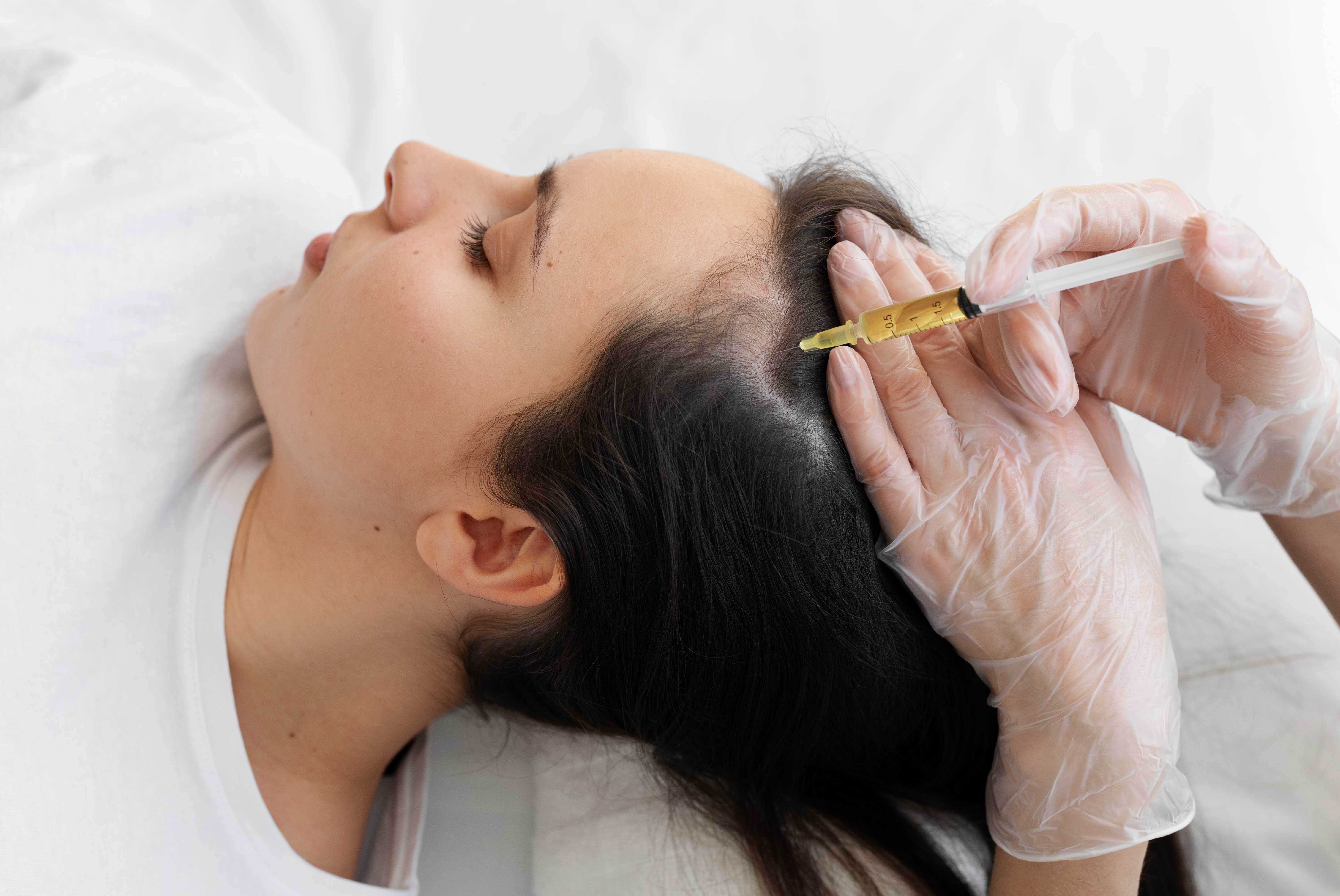 PRP Hair Treatment picture